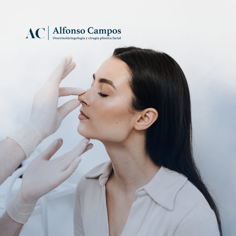 rinoplastia-ultrasonica-madrid