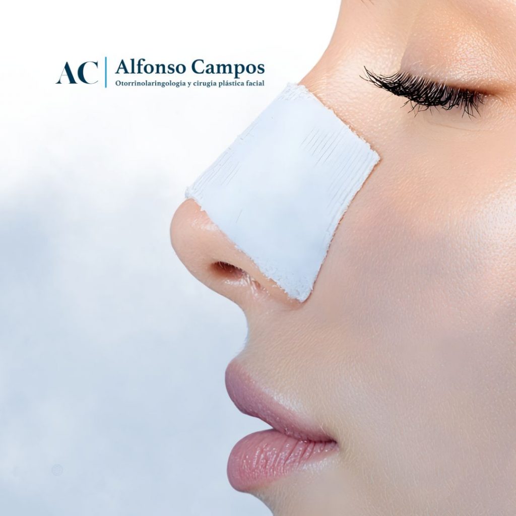 recuperación-rinoplastia